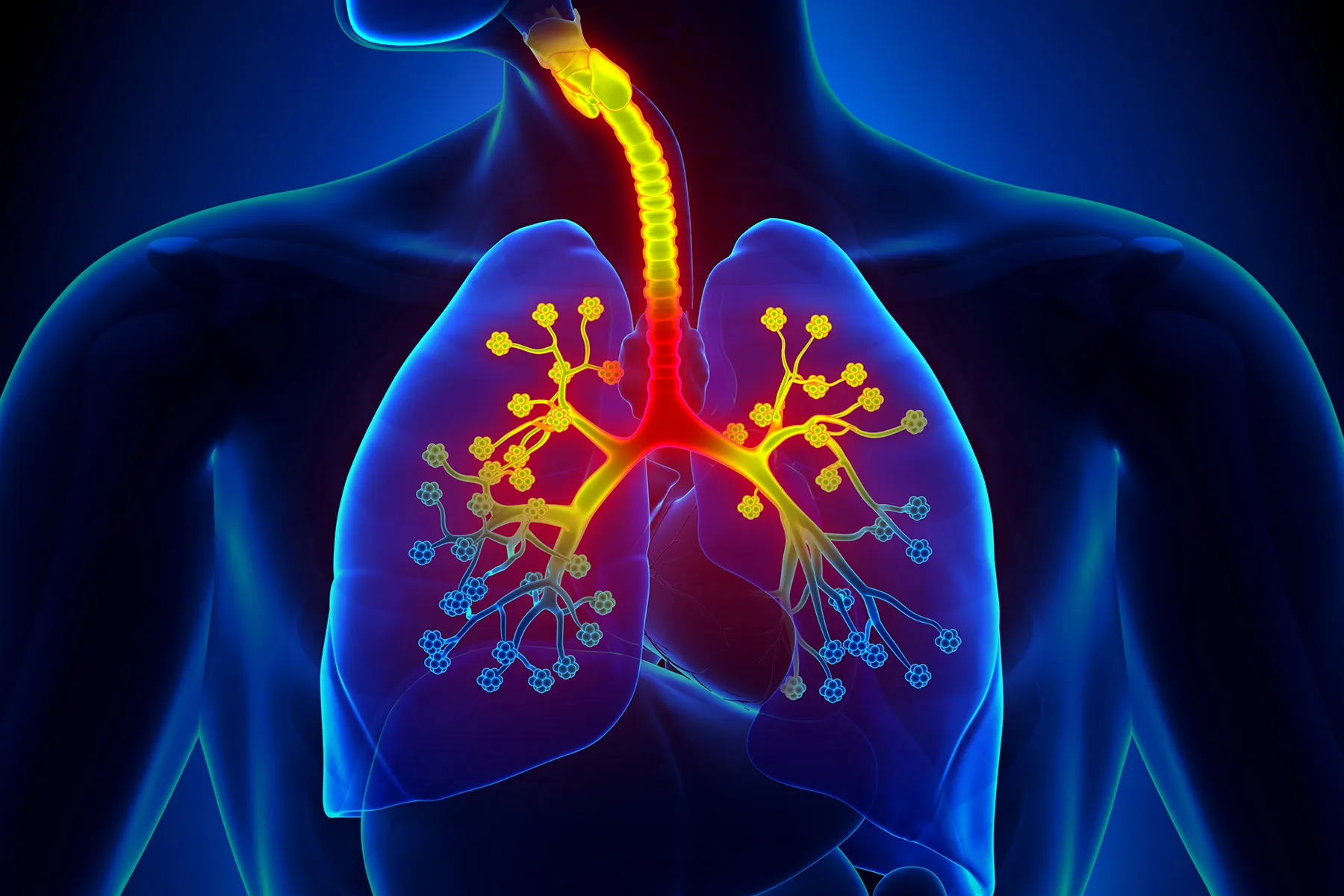 High Viral Load in Lungs Drives Fatal COVID-19