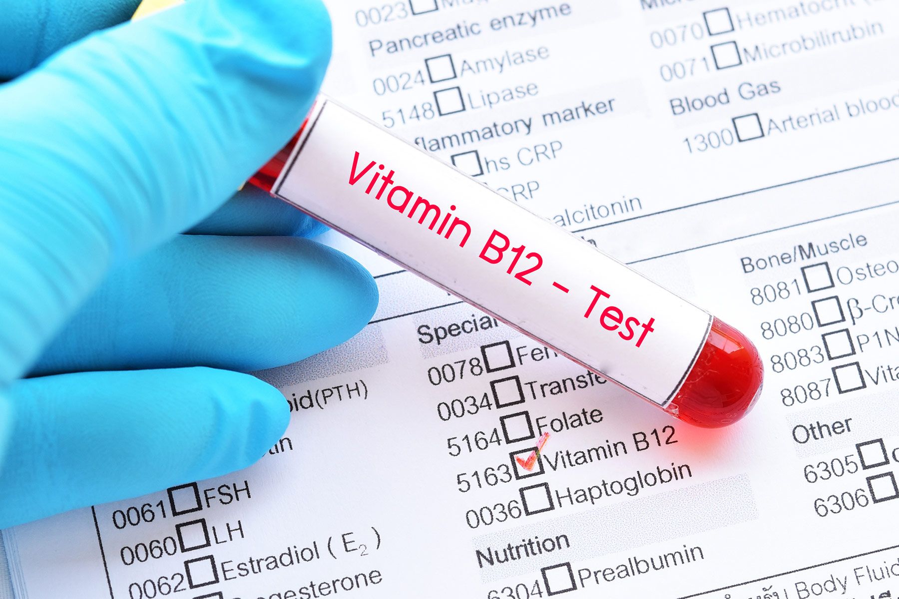 Vitamin B Overdose Symptoms Chart