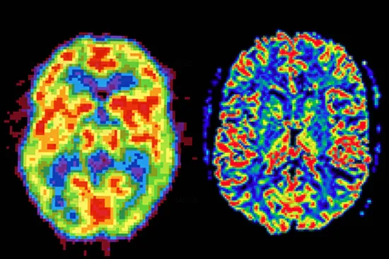 brain scansbrain scans