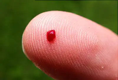 blood on finger