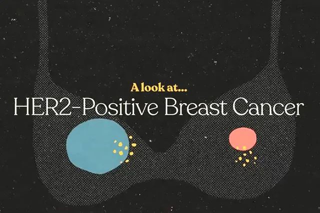 A Look at HER2-Positive Breast Cancer