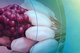 inside the body stages of breast cancer video