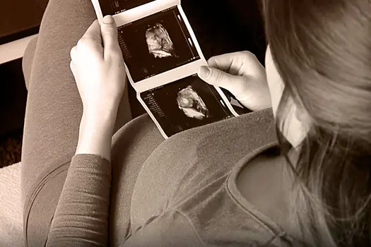 woman looking at ultrasound