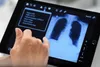 photo of x-ray on computer tablet