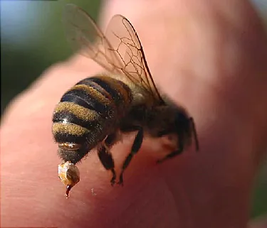 375x321_how_to_treat_a_bee_sting_video.j