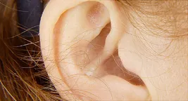 girls ear