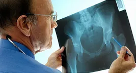 doctor looking at x-ray of a hip