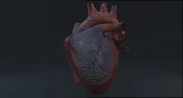 widow maker heart attack