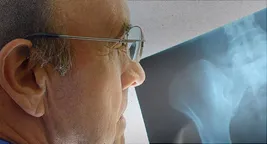 photo of doctor looking at X-ray