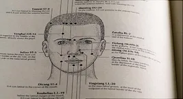 accupuncture illustration