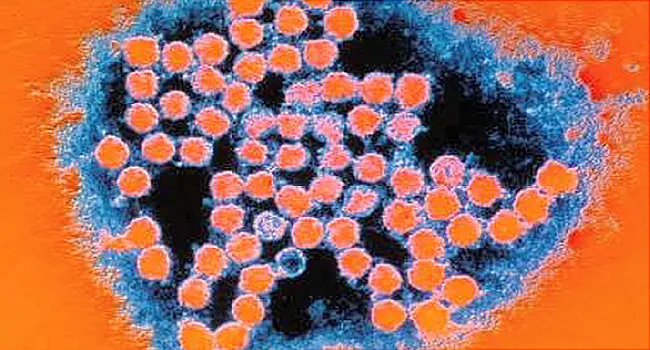 flu virus under microscope