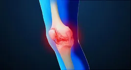 inflammed knee illustration