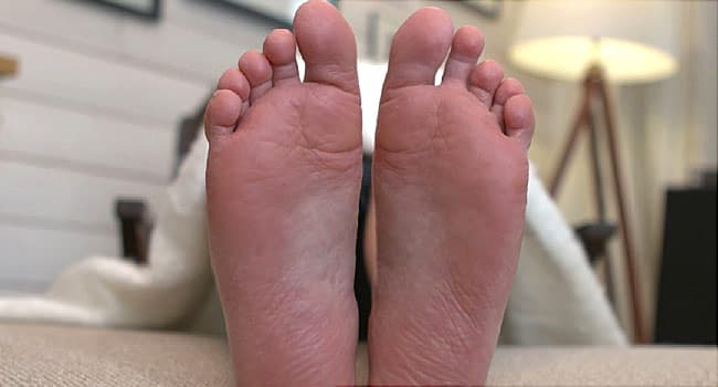 tender sole of foot