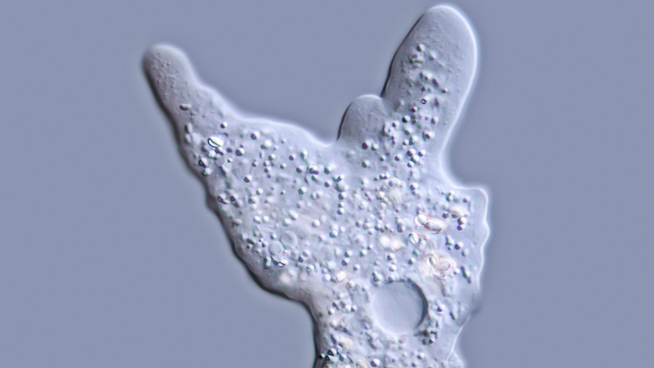 Girl who contracted a brain-eating amoeba while swimming dies at 10