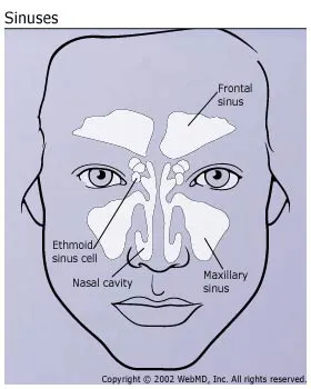 Headache Location Chart Meaning