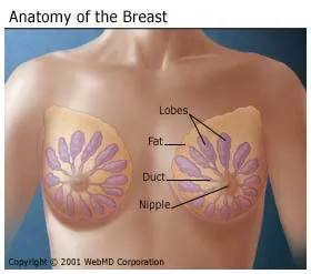 Breast Cancer: What It Is  What Causes It