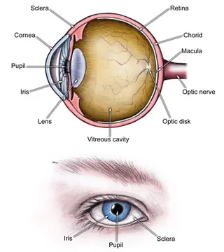acute_angle_closure_glaucoma1_revised!.jpg