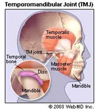 TMJ - Illustration of Temporomandibular Joint