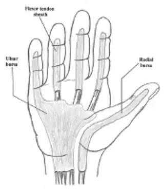 Finger Infection Hand Illustration