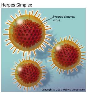 herpes vs cold sore