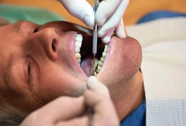 Teeth Whitening and Dental Procedures
