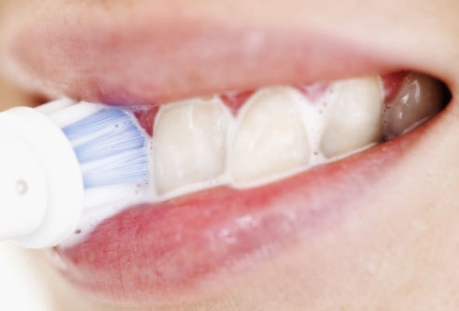 Whitening Toothpaste and Rinse