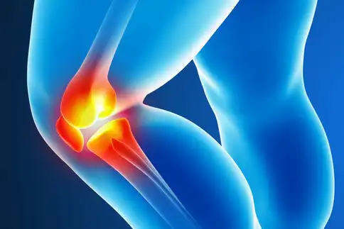 photo of joint pain