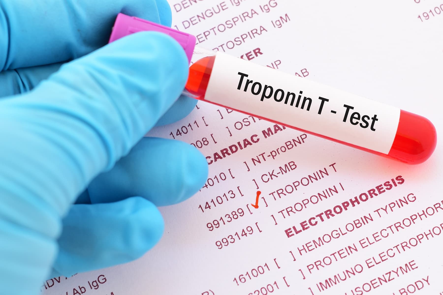 photo of Troponin T Test