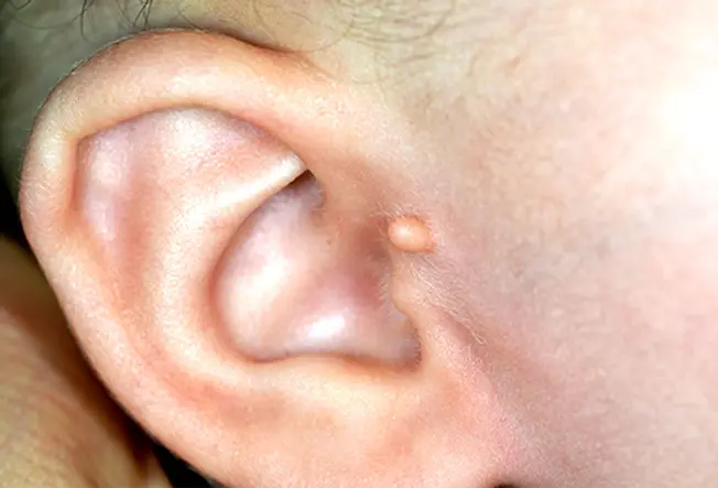 Unusual Ear Shape