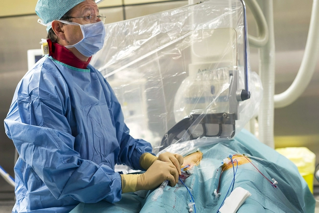 During the Procedure: Catheter