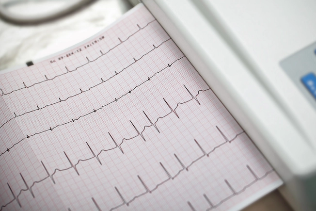 Anxiety and AFib May Be Linked