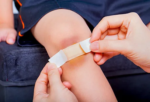 Child’s bruised knee with bandage