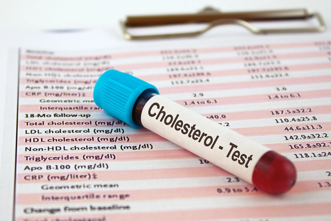 Is Cholesterol a Problem?