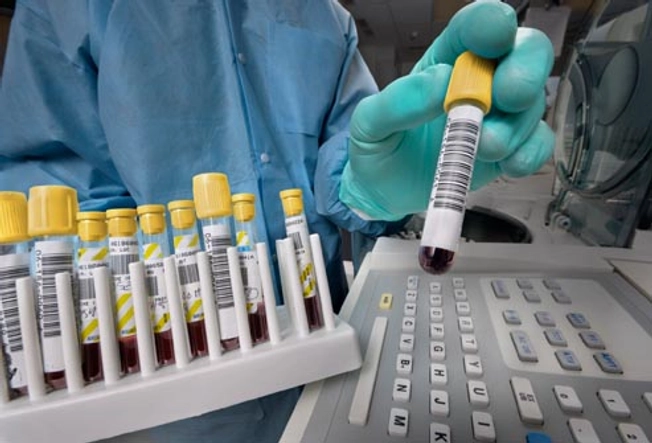 Diagnosis: Other Blood Tests