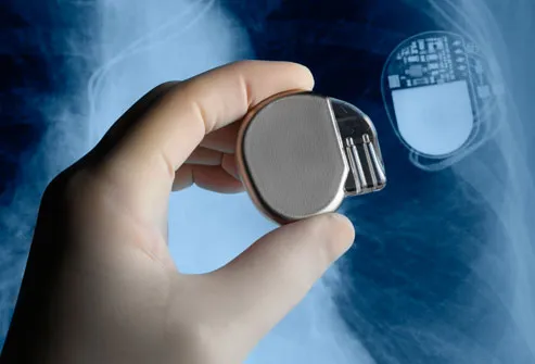 Pacemaker And Chest Xray