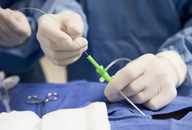 Surgeon Inserting Tube Into Heart