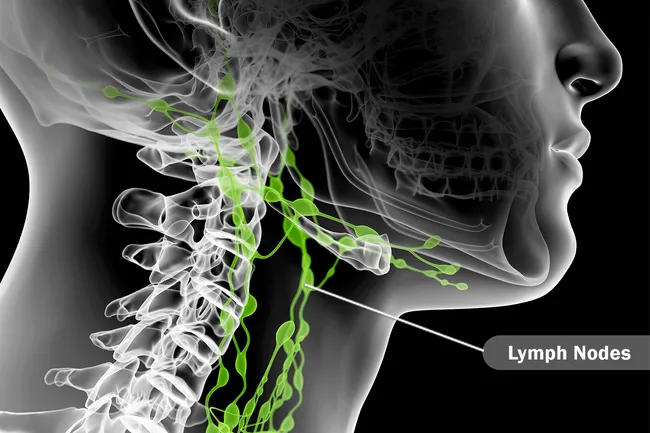 Diagram of lymph nodes