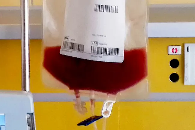 Stem cell transfusion