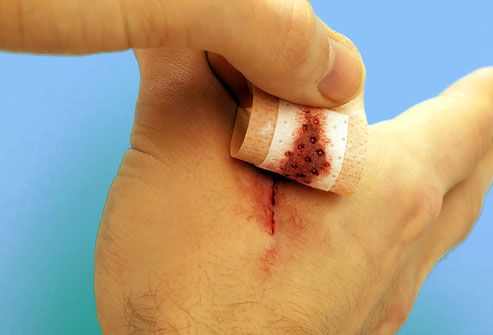 Man Removing Bandage from Hand  Wound