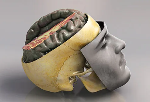 3d4medical rm photo of brain anatomy - ضربه به سر و مغز