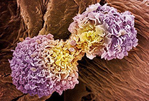breast cancer cell dividing