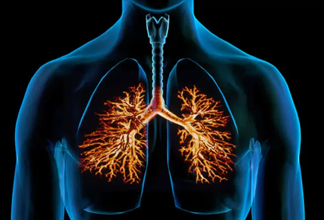 What is Bronchitis?