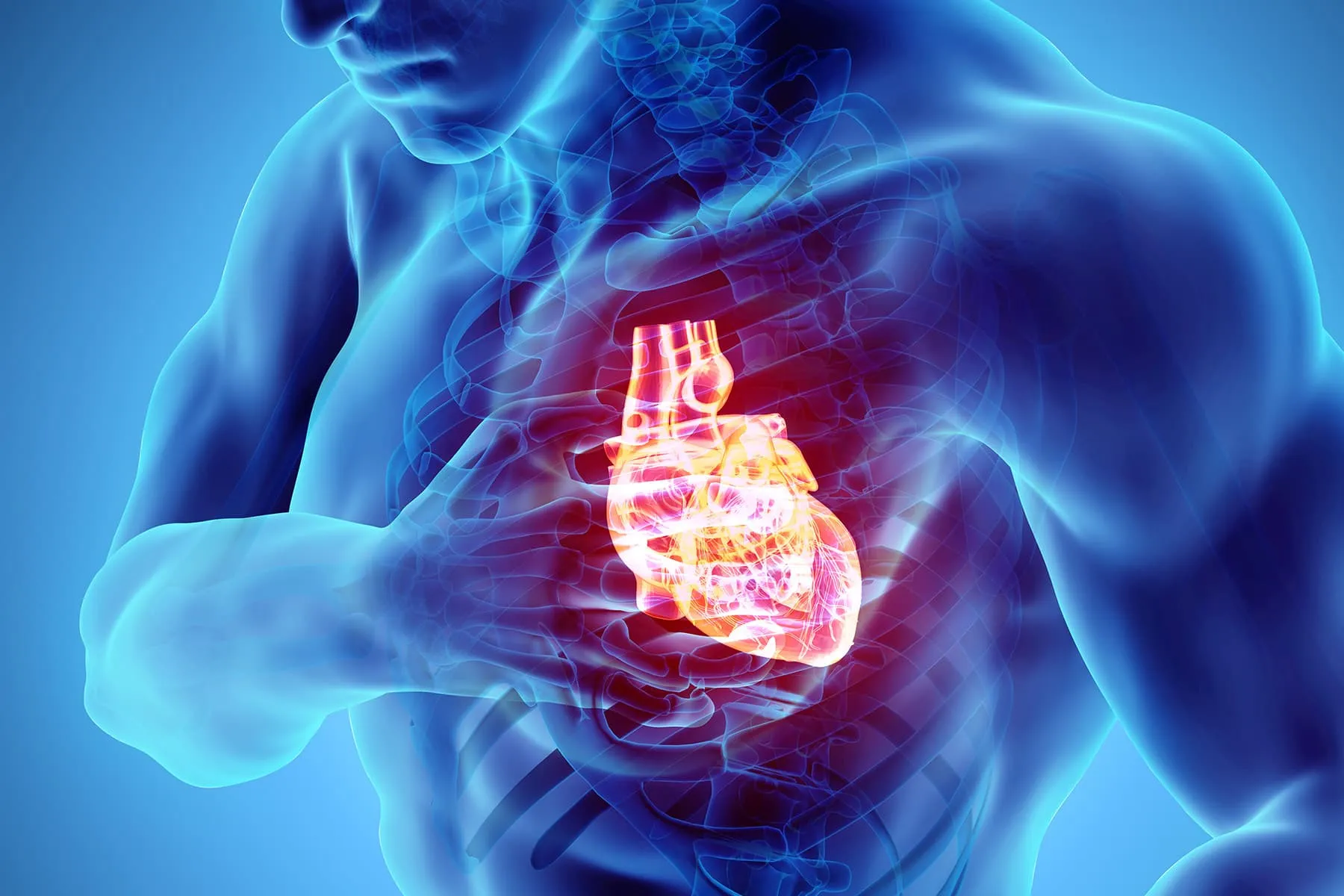 cardiac arrest illustration