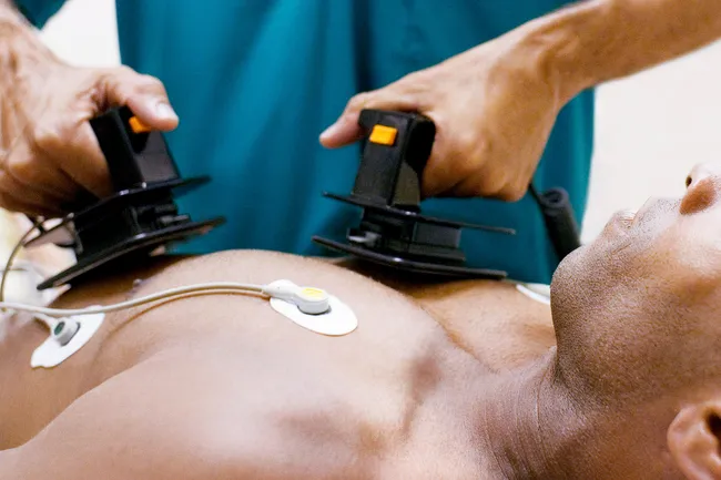 photo of using defibrillator