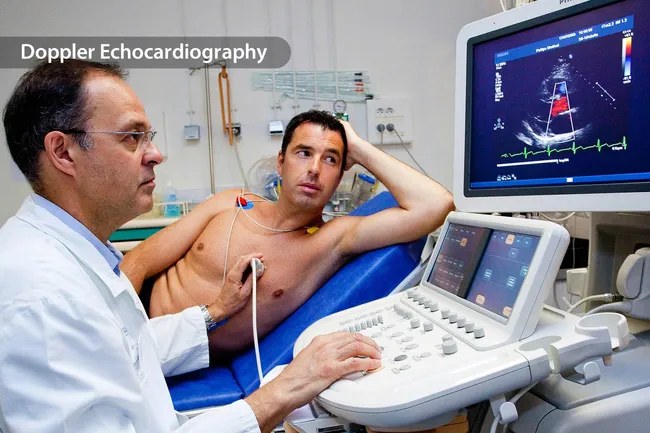 photo of doppler echocardiogram