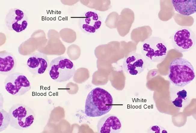 What's Happening in Your Blood?