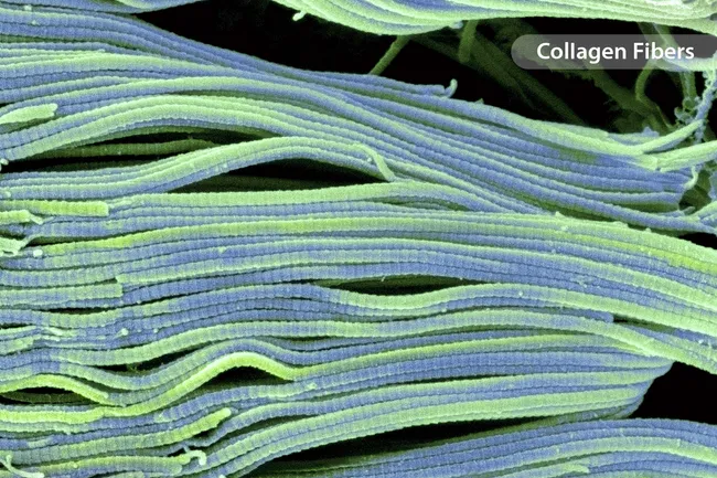 photo of collagen strands micrograph