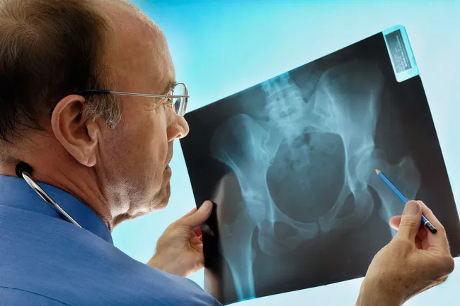 photo of doctor with xray