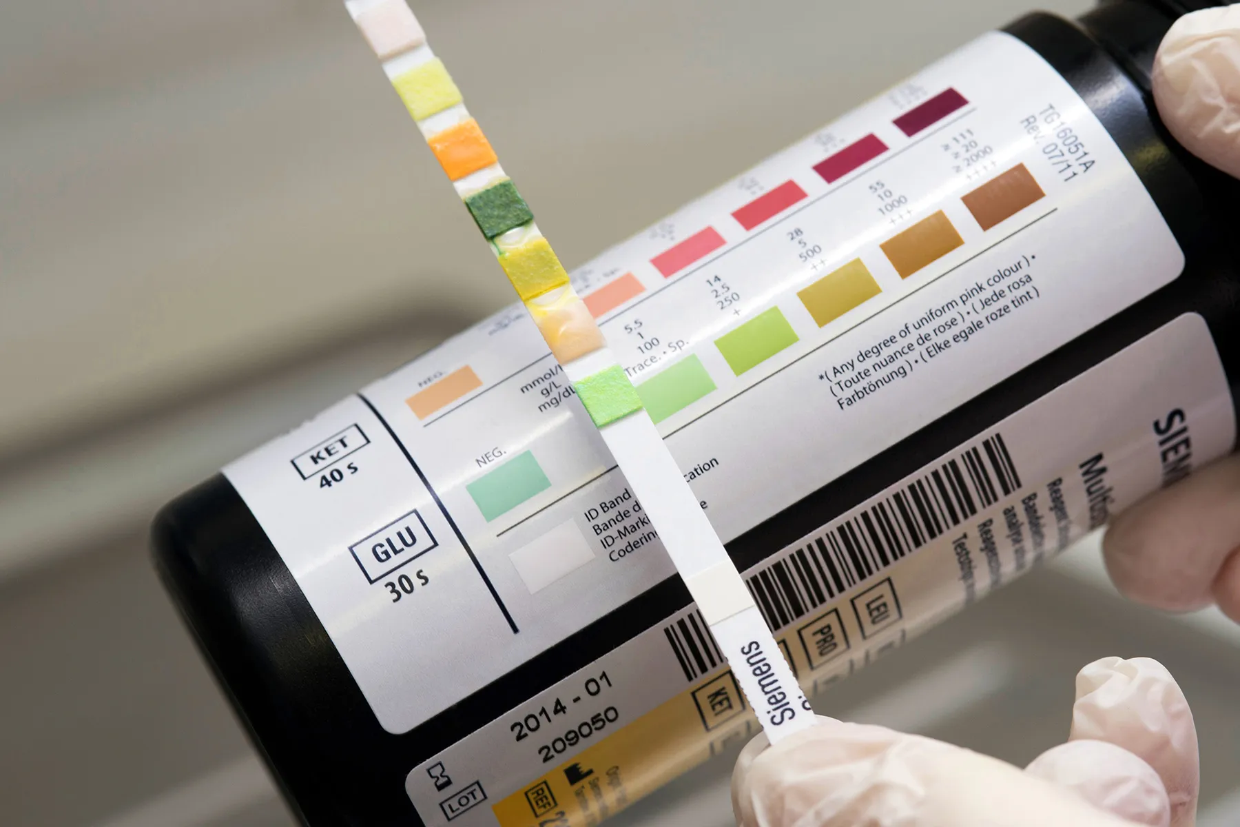 Diagnosticando as causas de sangue na urina