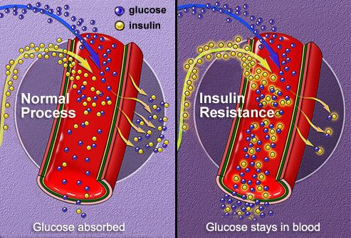 Normal insulin absorption vs insulin resistance